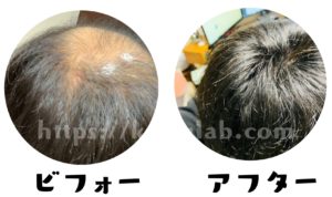 アートネイチャー増毛の口コミレビュー 編み込み式増毛法 を2年間体験してみてわかった事 カツラボ