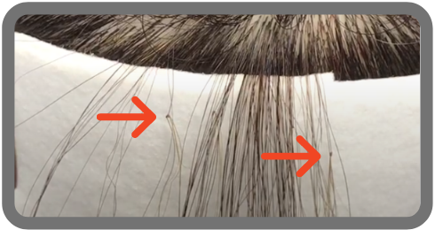 増毛はデメリットだらけでメリット無し 増毛のデメリットを暴露します カツラボ