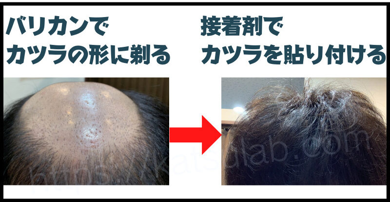 ヘアフォーライフってかゆい 経験者が仕組みや費用を解説しますよ カツラボ